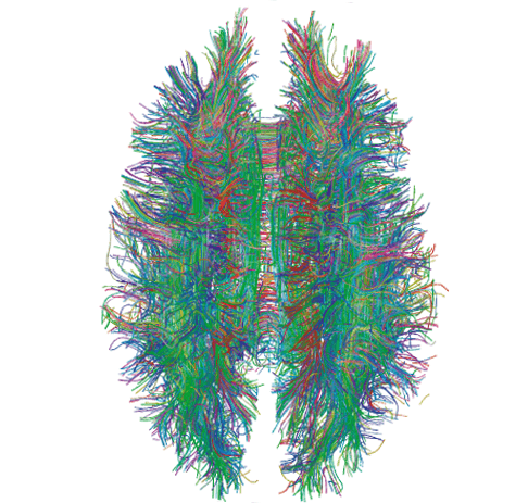 White_Matter_Connections_Obtained_with_MRI_Tractography